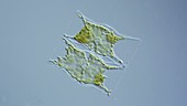 Mediopyxis diatoms, light microscopy