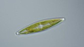 Stauroneis diatom, light microscopy