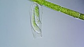 Thuricola protozoan, light microscopy