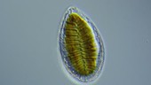Surirella diatom, light microscopy