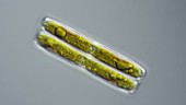 Pinnularia diatom dividing