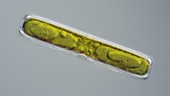 Pinnularia diatom, light microscopy