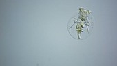 Testudinella rotifer, light microscopy