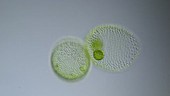 Volvox algal colony, light microscopy