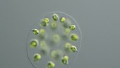 Eudorina algal colony, light microscopy