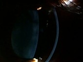 Human eye, cornea and lens