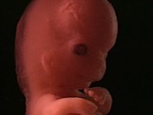 Human embryo, 8 weeks
