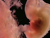 Human embryo, 5 weeks