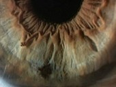 Human eye, iris