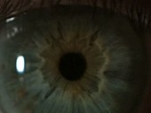 Human eye, pupil variation