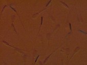Boar sperm cells, light microscope
