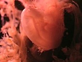 Human embryo, 3 weeks old