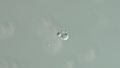 Plasmodium berghei, light microscopy