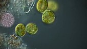 Dinoflagellates, light microscopy