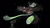 Stentor protozoa, light microscopy