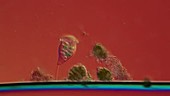 Vorticella, light microscopy