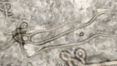 Ebola virus, SEM