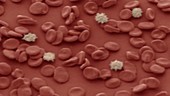 Infected blood cells, SEM