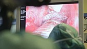 Larynx surgery on a monitor