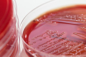Streptococcus pyogenes bacteria culture