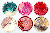 Bacterial growth on culture media