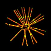 Asterionella diatoms,LM