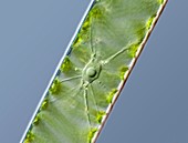 Spirogyra green alga,LM