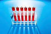 Blood samples in tubes