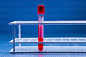 Vacutainer tube with blood sample