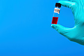 Person holding virology test tube
