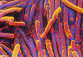Clostridium difficile bacteria