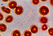 Lyme disease bacteria Borrelia