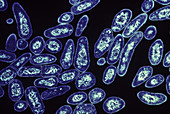 Tuberculosis bacteria,TEM