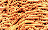Bacillus cereus bacteria,SEM