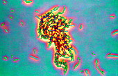 Anthrax bacteria
