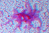 Botulism bacteria,light micrograph
