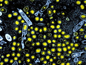Anthrax bacteria,light micrograph