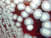 Bacillus Anthracis Culture