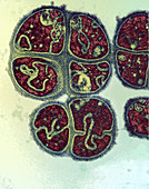 Micrococcus tetragenus