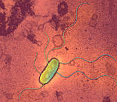 Escherichia coli Strain