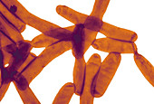 Legionella pneumophila