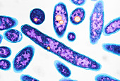 Legionnaires disease bacteria