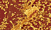 Staphylococcus biofilm