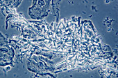 4 phase contrast- candida albicans