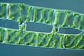 LM of conjugating filaments of Spirogyra