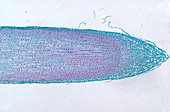 Onion root tip