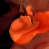 Foetus at 8 months