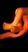 Legs of a foetus at 20 weeks