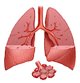 Lungs With Fluid
