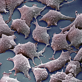 Human Fibroblast Cells